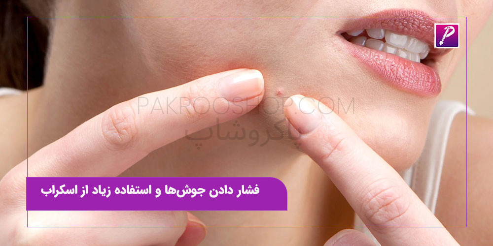 اشتباهات رایج در مراقبت از پوست؛ فشار دادن جوش‌ها و استفاده زیاد از اسکراب